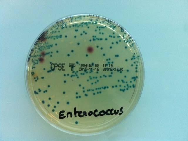 Recap from August Meeting - Enterococcus https://commons.wikimedia.org/wiki/file:cpse_enterococcus2.jpg What is it?