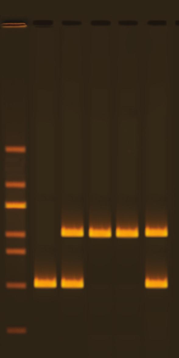 700 bp Homozygous for Alu insertion (+/+) 5 Student #3 700 bp Homozygous for Alu insertion (+/+) 6 Student #4 700, 400 bp Heterozygous for Alu insertion (+/-) Note Depending on the PCR conditions