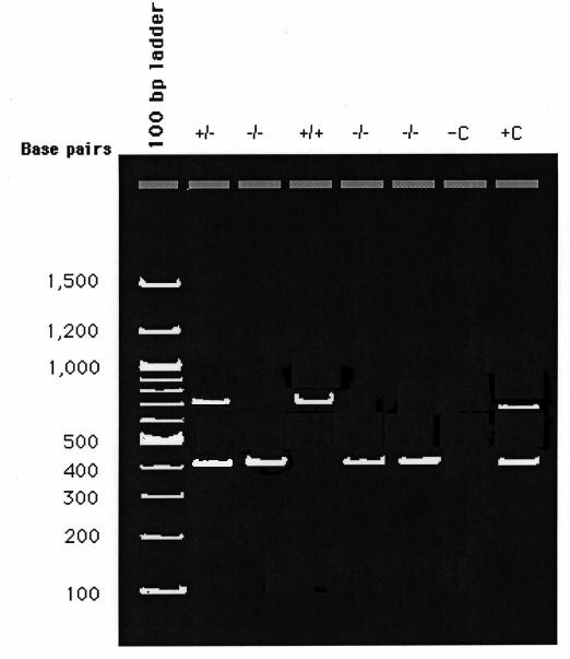 Figure 6. Agarose gel of homozygous and heterozygous individuals for the PV92 Alu insertion. A 100 base pair ladder is loaded in the first lane and is used as a size marker.