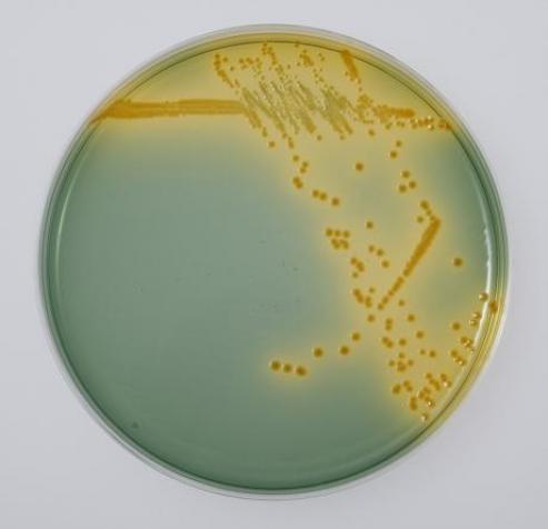 Thiosulfate-Citrate-Bile salts- Sucrose (TCBS) agar For Vibrio cholerae Mannitol salt agar (MSA) For