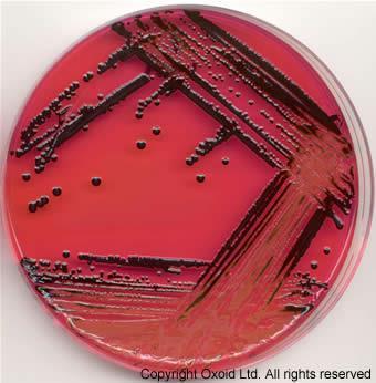 Indicator Medium These media contains an indicator which changes its colour when a bacterium grows in them.