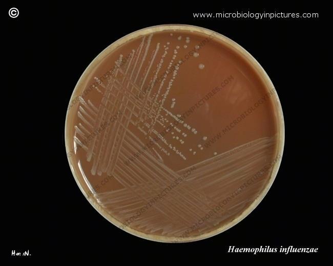 e.g. Blood agar for isolation of Streptococcus e.g. Chocolate agar for isolation