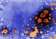 ATCC Quantitative Molecular Standards Blood-borne disease BK Virus Hepatitis B virus Hepatitis C virus Epstein-Barr virus Human