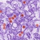 Human immunodeficiency virus 1 Human papillomavirus 16 Human papillomavirus 18 Human papillomavirus 31 Human T-cell leukemia virus 2