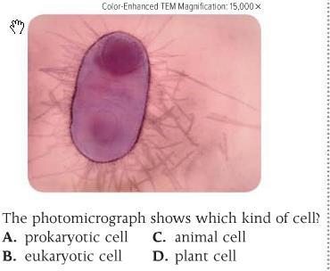 (c) Organelles are basic units of all organisms. (d) (e) Compare and contrast eukaryotic and prokaryotic cells.