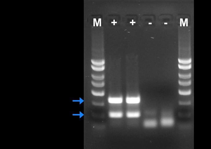 Figure 1: A representative 1X TAE, 1.4 % agarose gel showing the amplification of E. amylovora at different concentrations. The size of the E.