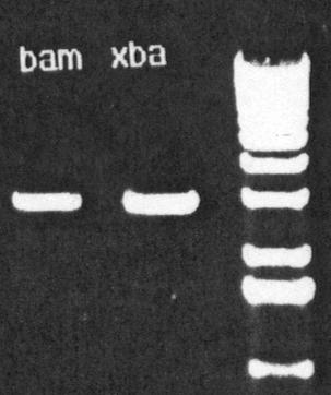Check the quality of the PCR products after