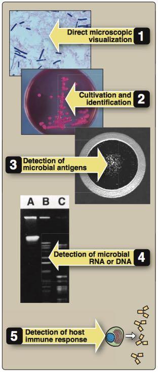 microorganism Definitive microbiologi diagnostic: Direct microscopic visualization Cultivation and