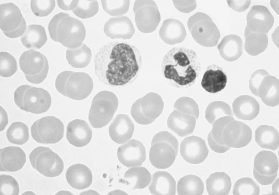 3 (a) Blood is made up of cells, plasma and platelets. The picture below is of blood cells as seen down a microscope.