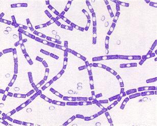 Anthrax Bacillus anthracis Gram (+), non-motile, aerobic, spore forming rod Streptobacilli with central spores