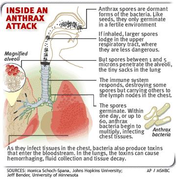 3. Inhalation Anthrax Initial symptoms resemble common cold Progress to severe breathing problems and shock Usually results in death