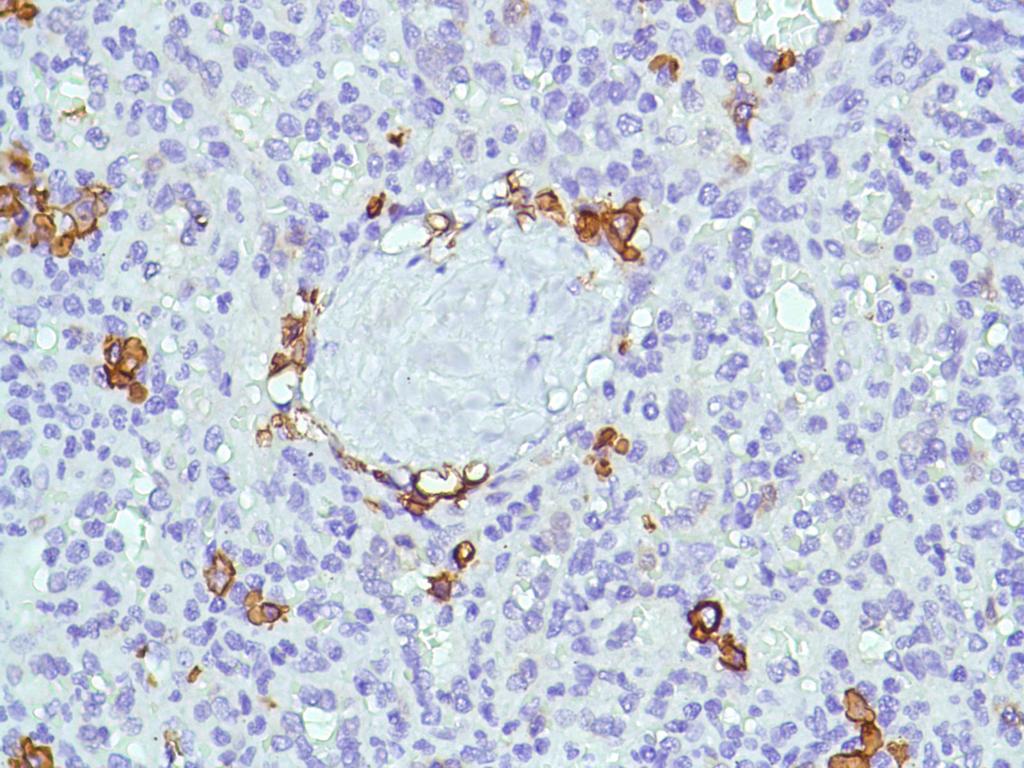 (ARG52708)  stained with CD38 antibody