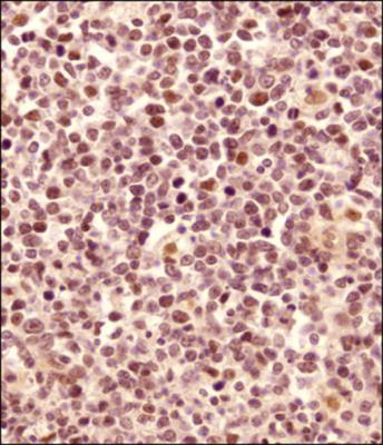 Images Immunohistochemistry-Paraffin: LMO2 Antibody [NB110-83978] - IHC analysis of a formalin fixed and paraffin embedded tissue section of human tonsil using LMO2 antibody