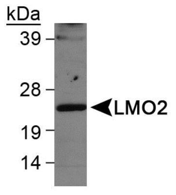 This LMO2 antibody generated an expected nuclear staining in a subset of cells in the germinal centers of tonsil section. Page 2 of 4 v.20.