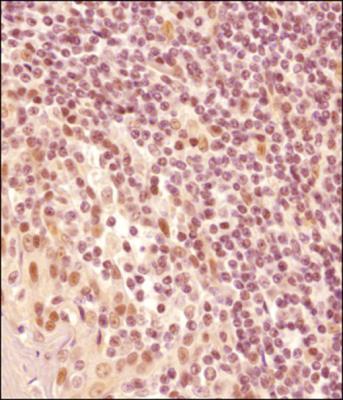 Immunohistochemistry-Paraffin: LMO2 Antibody [NB110-83978] - IHC analysis of a formalin fixed and paraffin embedded tissue section of human tonsil using LMO2 antibody  This LMO2