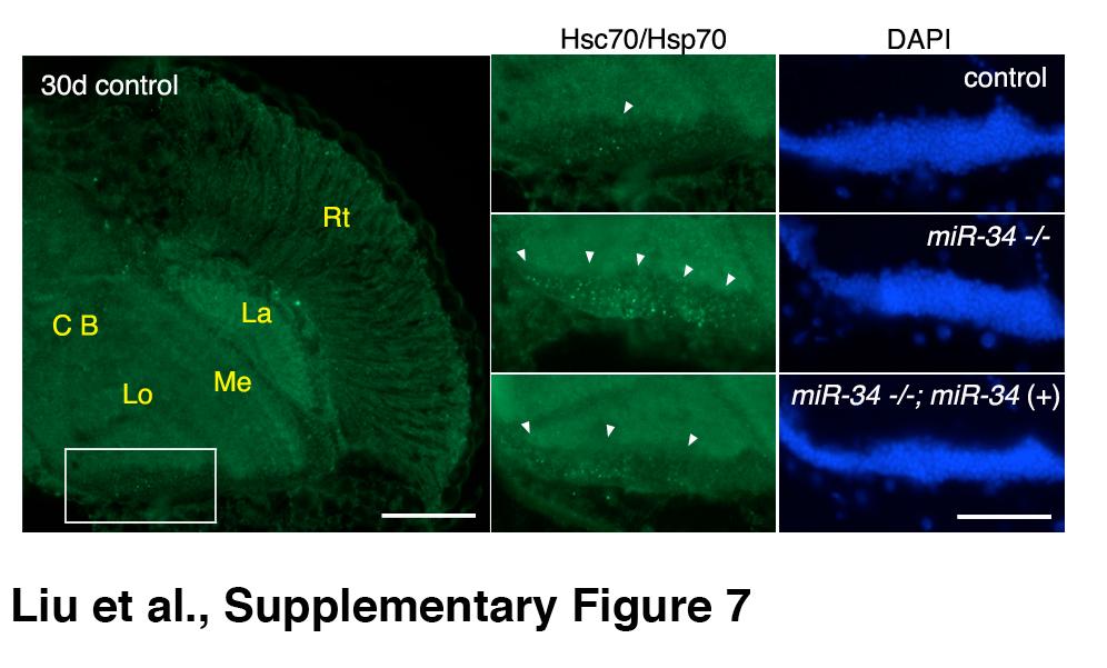 Supplementary Fig.7: mir-34 mutant flies show Hsp70/Hsc70 positive accumulated material. Left panel, a representative cryosection of a control fly brain (30d), with anatomical structures noted.