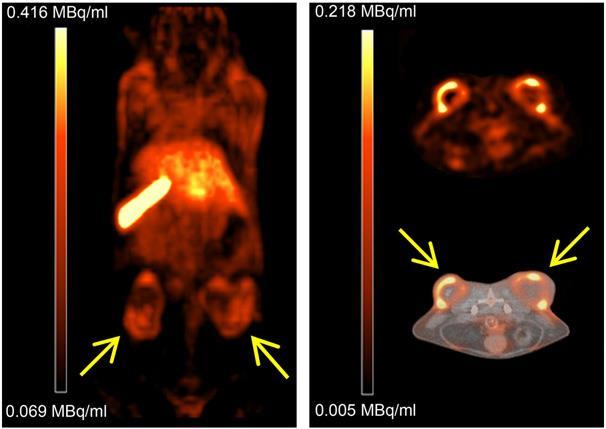 Positron emission tomography (PET)/computed tomography (CT)-images of 64Cu-liposomes distribution in tumor-bearing mice.
