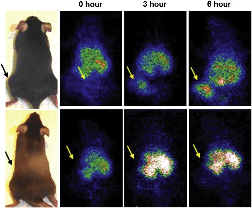 Whole body imaging of Lewis lung carcinoma tumor-bearing mice at different time points after injection of 111In-labeled PEGylated