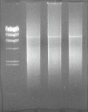 D. 2nd PCR 1) Dilute some portion of the 1st PCR product and prepare 3 kinds of samples; original, 10 times-diluted, and 100 times-diluted.