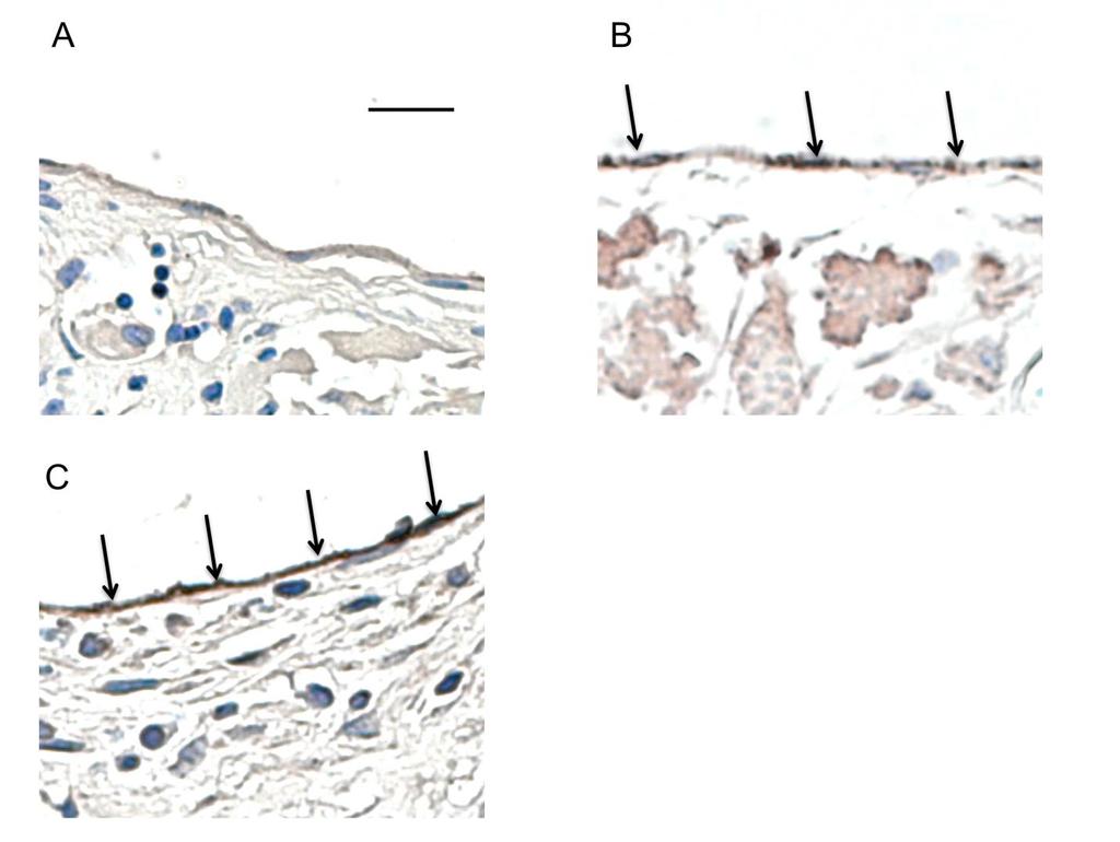 Figure 5.9 Endothelial Cell Staining of TEGVs.