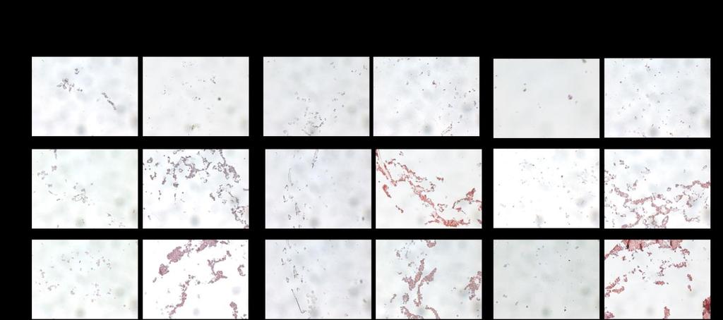 Figure 6.5 Immunohistochemical staining to demonstrate tissue formation and marker expression within cross-sectional cuts of grafts cultured in static or dynamic cultures. 6.4 Discussion EPCs provide a promising cell type for the seeding of TEVGs.