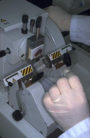 Sectioning with microtome Rotation of the drive wheel moves the