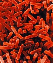 Legionella An Acute Manifestation Of Poor Maintenance Each year, between 8,000 and 18,000 people are hospitalised with Legionnaires disease in the U.