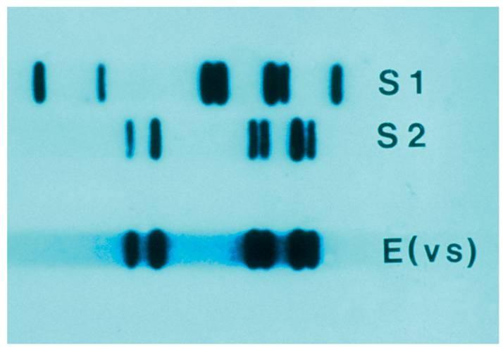 Restriction enzyme digested DNA samples are placed in the wells. Because DNA has a negative charge, it migrates toward the anode.