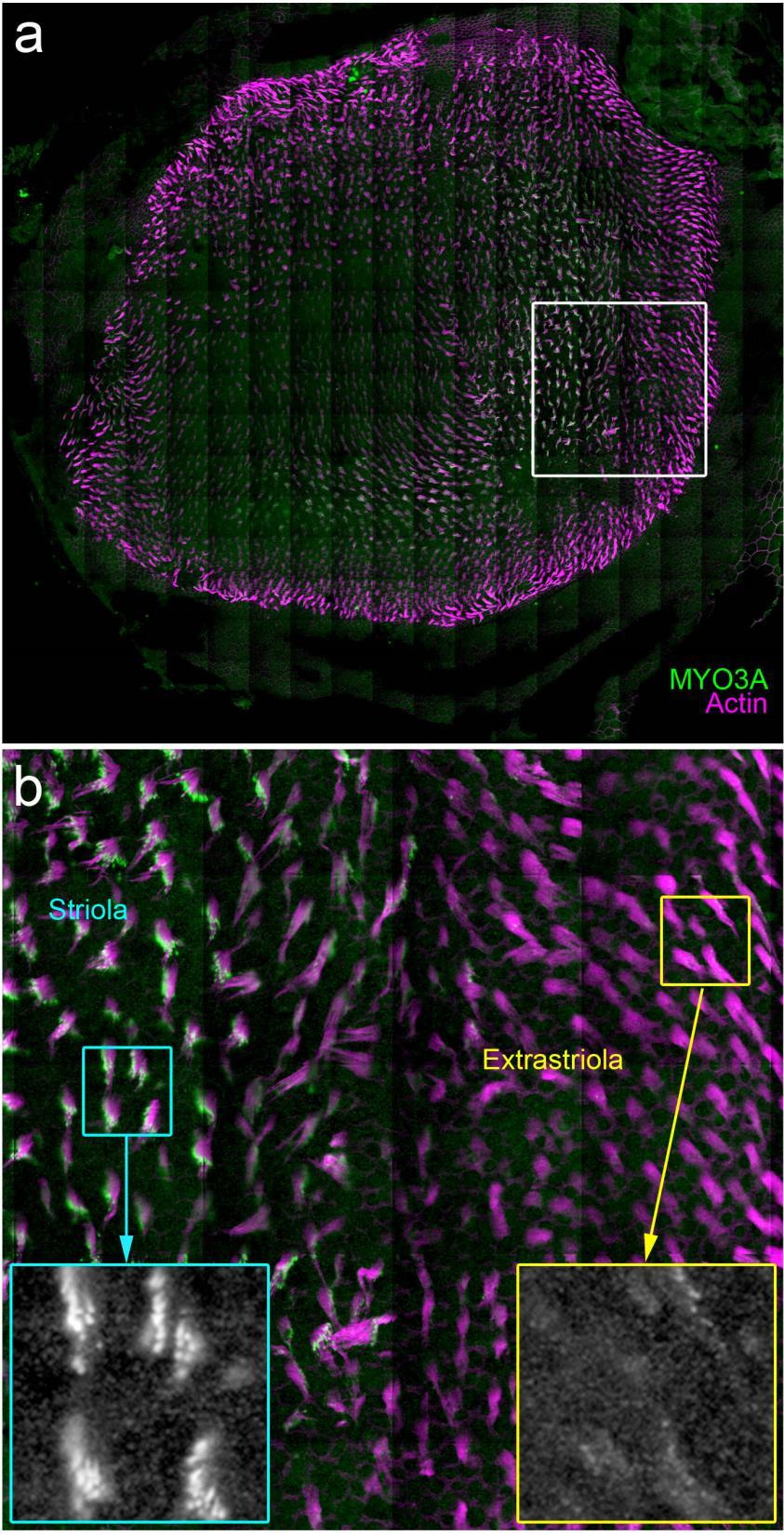 Supplementary Figure 3. High-resolution view of MYO3A in the striolar region of the utricle. (a) Survey of utricle at low resolution. (b) Magnification of region indicated by white box in panel (a).