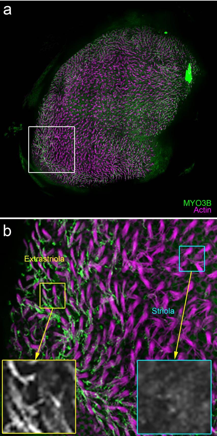 Supplementary Figure 4. High-resolution view of MYO3B in the extrastriolar region of the utricle. Same figure layout as Supplementary Figure 3.