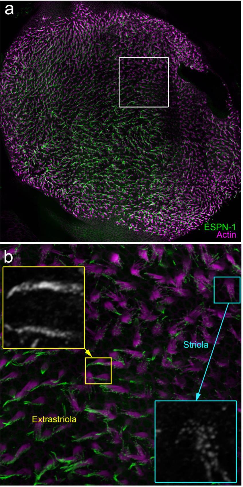 Supplementary Figure 6. High-resolution view of ESPN-1 in the extrastriolar region of the utricle. Same figure layout as Supplementary Figure 3.