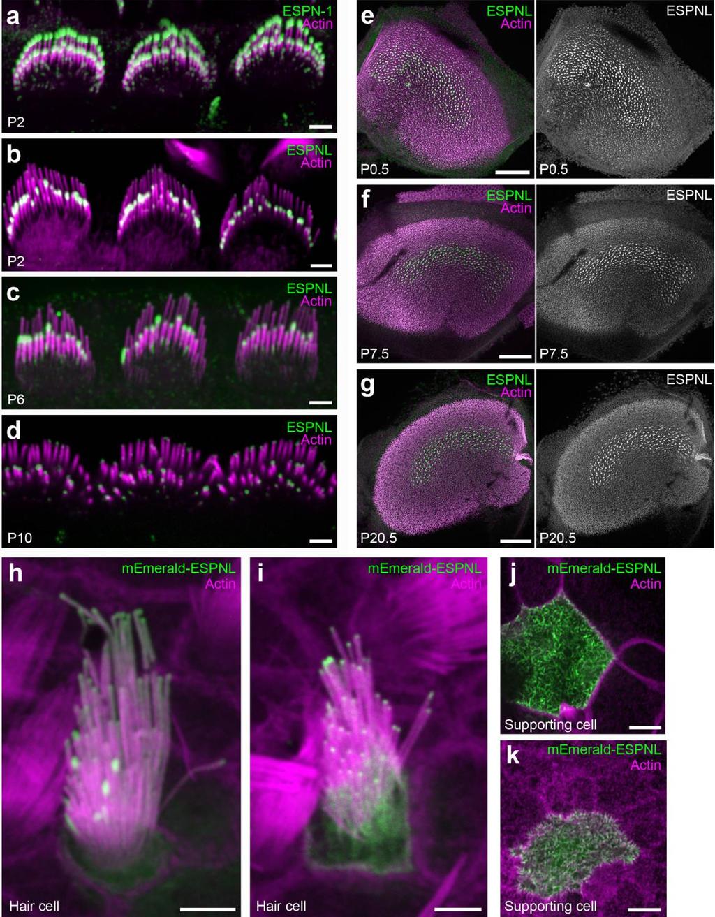 Supplementary Figure 8. Development of ESPNL immunoreactivity in cochlear and vestibular hair cells. (a) ESPN-1 labeling (green) in P2 cochlear inner hair cells.