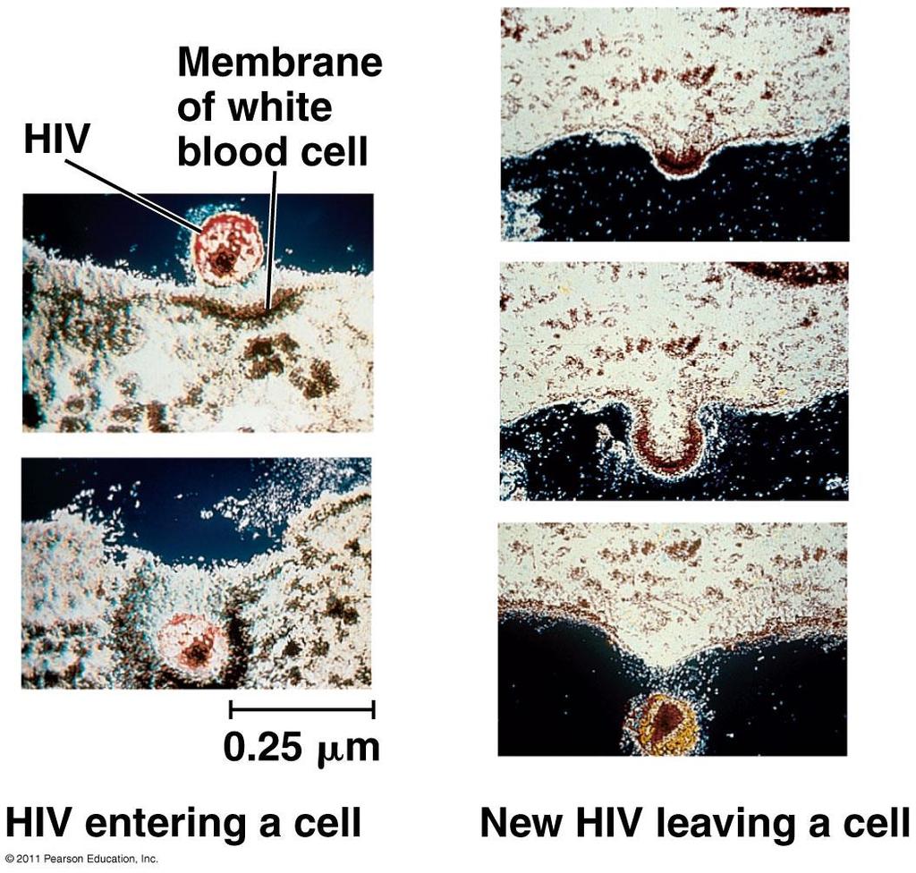 HIV Infects white blood cells HIV+: provirus