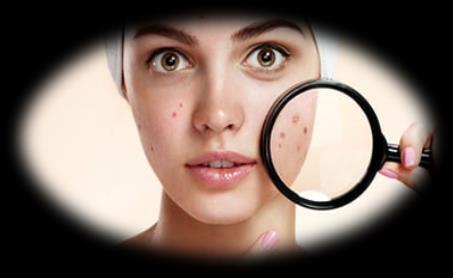 BX001 Acne Candidate to Enter Clinic H1