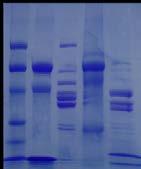 Related Products NEW! Diagnosing Huntington s Using PCR For 5 Complete Sets of Reactions.