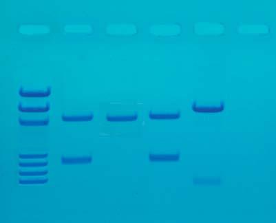 EDVO-Kit 130 DNA FINGERPRINTING BY PCR AMPLIFICATION INSTRUCTOR'S GUIDE Experiment Results and Analysis In the idealized schematic, the relative positions of DNA fragments are shown but are not