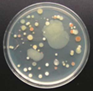 variety of bacteria TCBS Selective for Vibrio spp.