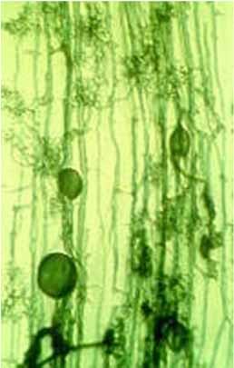 phosphorus Fungus received energy and nutrients from plants Root cells VAM fungi growing