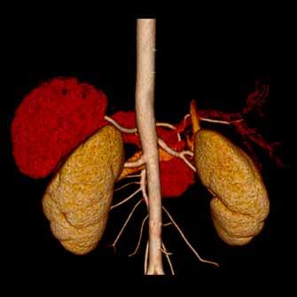 The kidneys are normal in size,