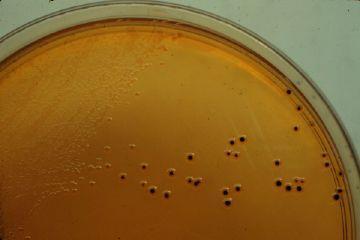 Salmonella-Shigella agar (selective for salmonella and shigella), Macconkey agar (selective for Enterobacteriaceae to grow).