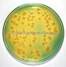 CLED agar (cysteine lactose electrolyte deficient medium) CLED agar
