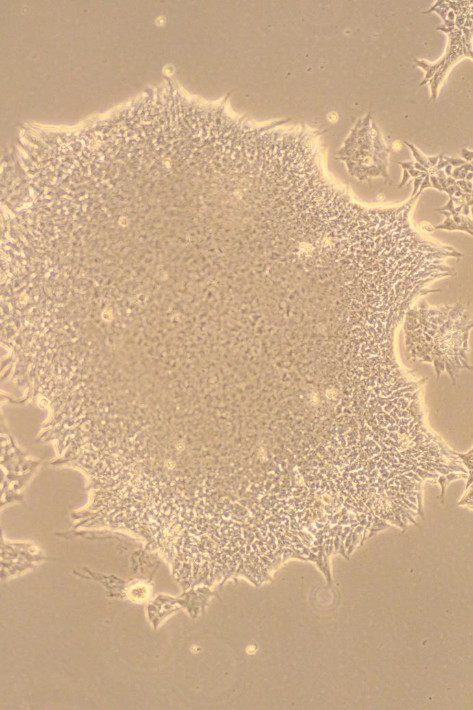 Appendix: Figures Figure 1: Figure represents a mature ips colony growing on Vitronectin XF coated plate in CET s Complete ips Growth Media.