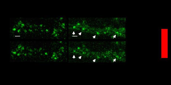 Distance of two arrows around 130 m)) Chemical stimulation-induced synaptic plasticity Cultured hippocampal neurons labelled with 1 M of LiveReceptor AMPAR were treated with