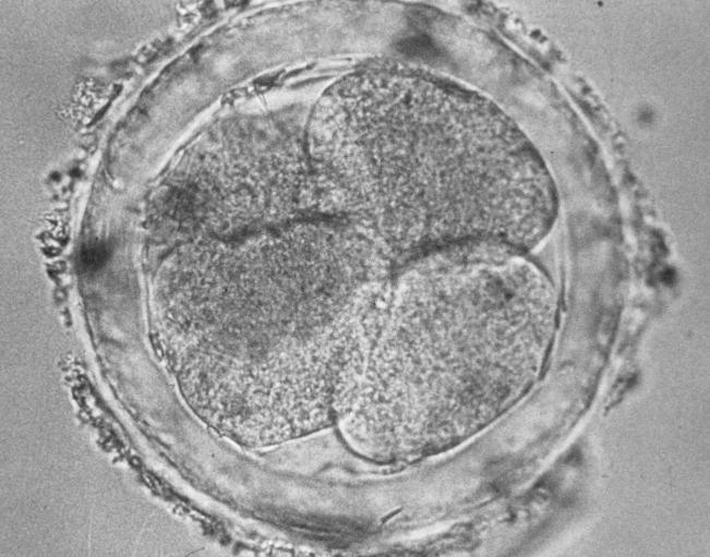 20 Stem Cell Research A human embryo, five to 10 days old (Claude Edelmann/Photo Researchers, Inc.) cultures showed that three of the cell lines were male (XY) and two were female (XX).