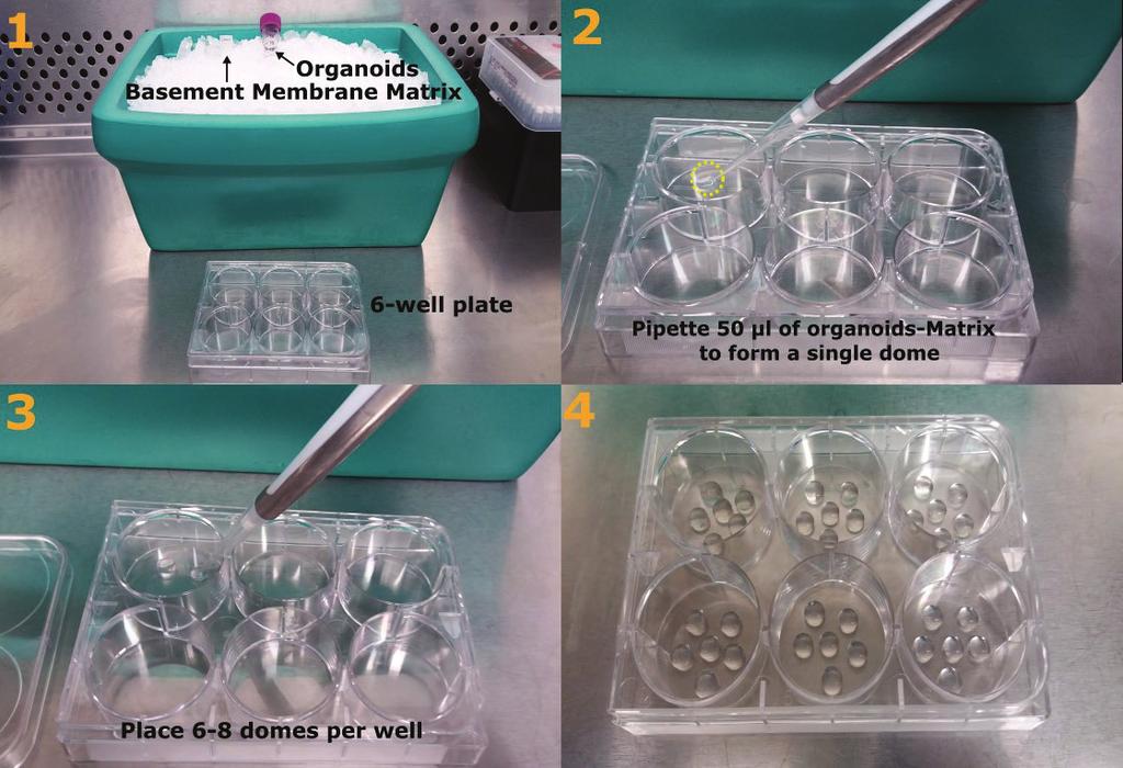 Organoid Culture Maintenance The culture medium should be aspirated from each well and replaced with fresh Organoid Culture Medium every other day.
