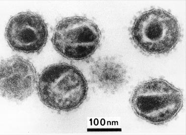 Lentivirus Lentivirus are complex retrovirus