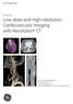 Low-dose and High-resolution Cardiovascular Imaging with Revolution* CT