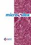 Characterization and Effects of Microsilex and Silica Fume on Cement Paste, Mortar and Concrete properties