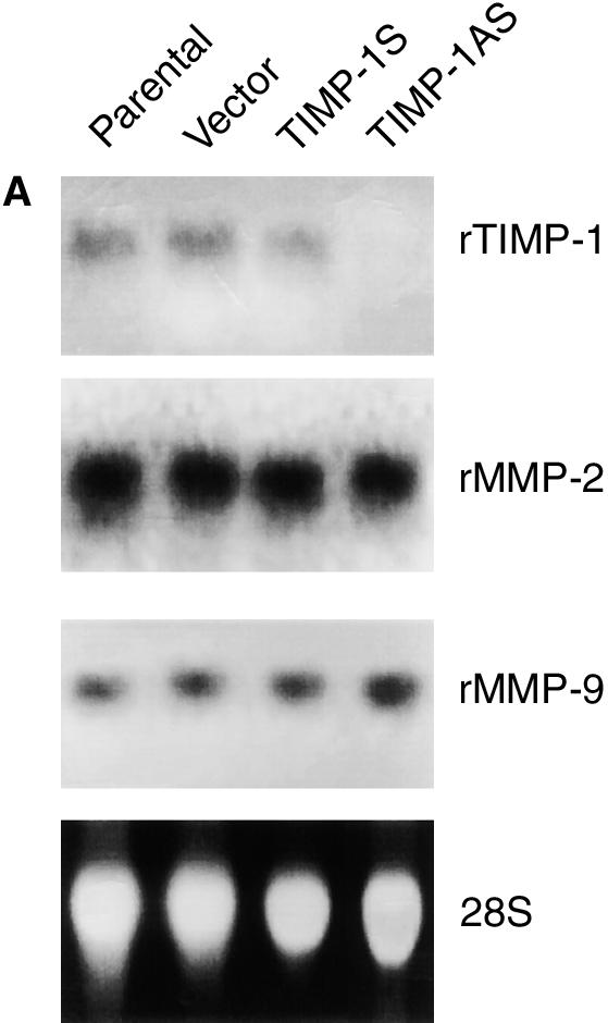Numbers at the left correspond to relative molecular weight of protein in kilodalton. Cells transfected with sense TIMP-1 expressed the TIMP-1 protein.