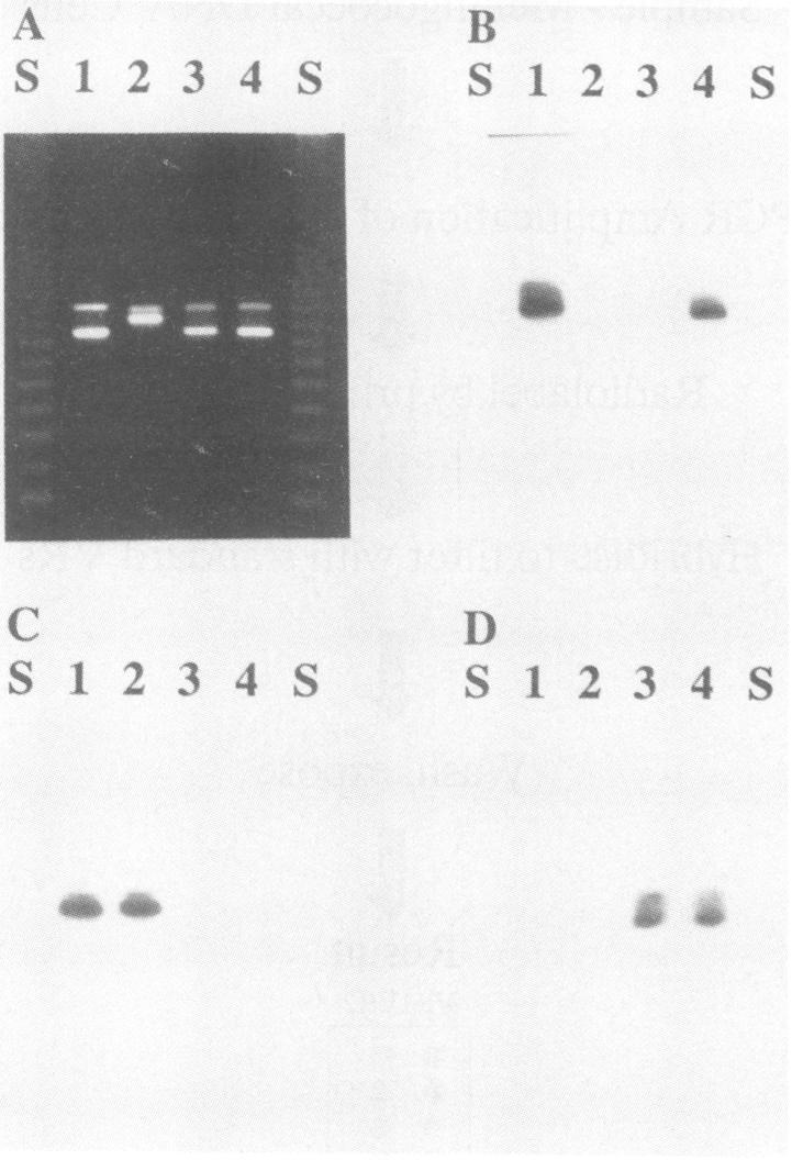 1 2/B 2 2996 (2005) P1.2 2/C 2 M982 (2004) P1.9 2/D 2 B40 (2151) P1.10 2/E 2 H355 (2008) P1.15 2/F 2 S3032 (2007) P1.16 2/G 2 M990 (2002) FIG. 2. Southern hybridization discriminates between genes encoding antigenic variants of the class 1 OMP.